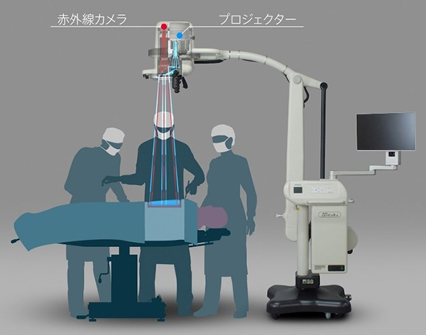 プロジェクションマッピングの技術を医療の現場に応用 手術ガイドシステム「MIPS」を京都大学が開発