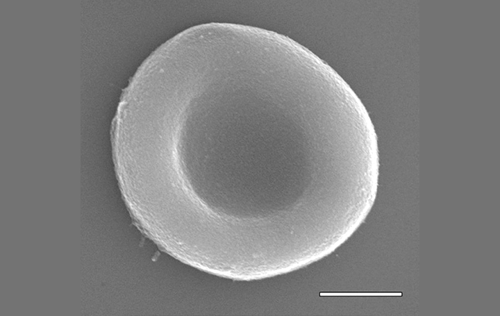 アメリカ化学会が新しい「人工赤血球」の開発を発表 機能が拡張された人工赤血球は医療の可能性が広がる